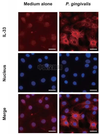 通道载玻片--受牙龈菌感染的Ca9-22细胞中IL-33免疫荧光染色实验