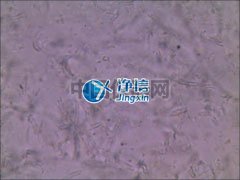 全自动样品快速研磨仪研磨青霉菌提取线粒体实验-上海净信